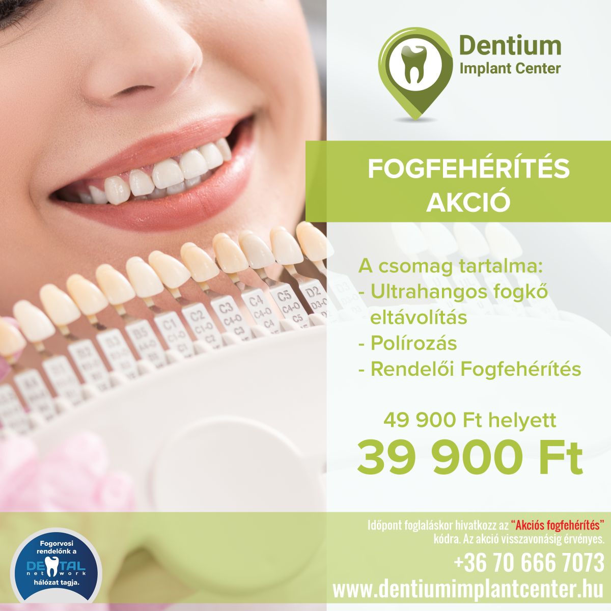 Fogfeh r t s akci Dentium Implant Center Budapest